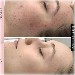 Instalash - Double-Sided Cleansing Brush for Sensitive Skin - Eyes - Professional Make Up - Avvenice